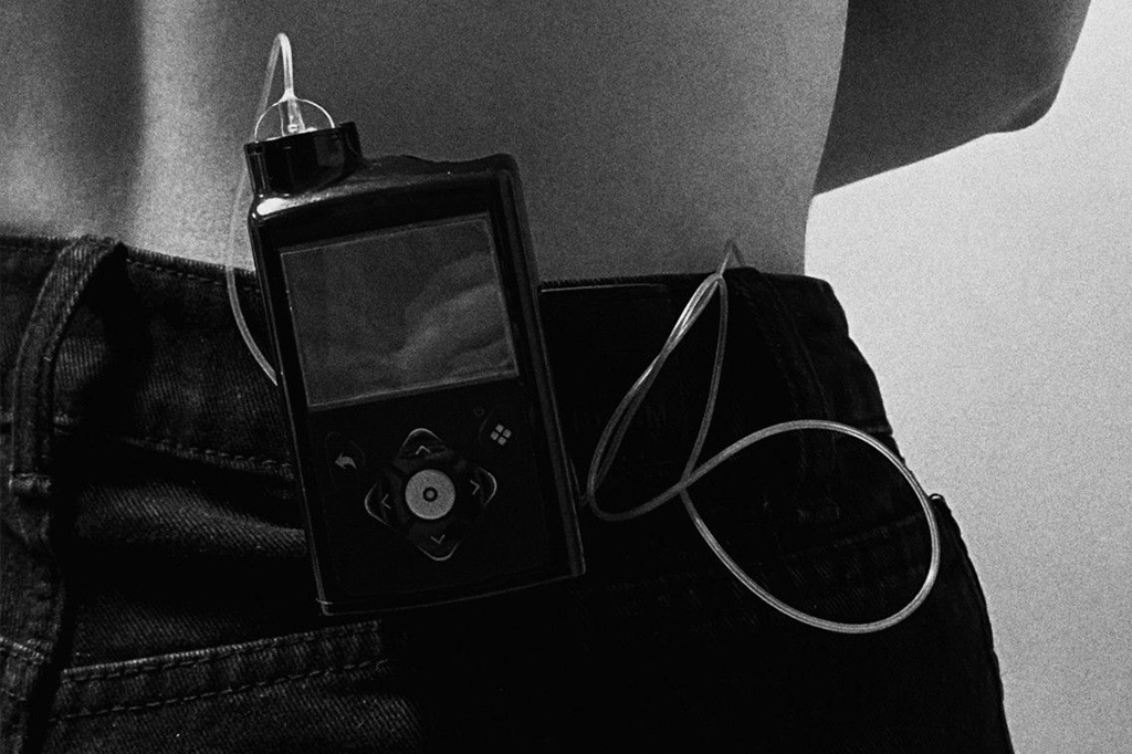 Resistência à insulina: o que é, como prevenir e quando procurar ajuda